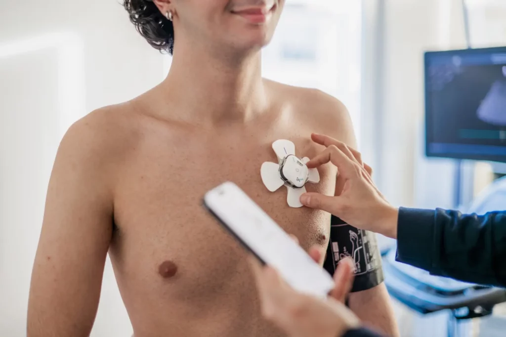 EKG