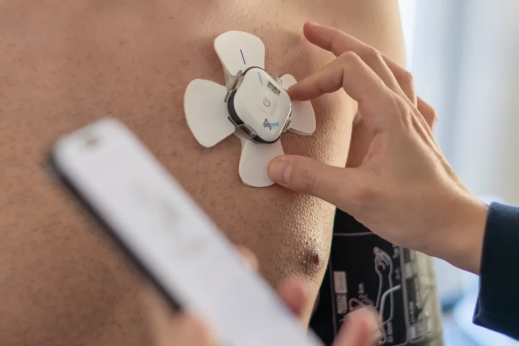 EKG